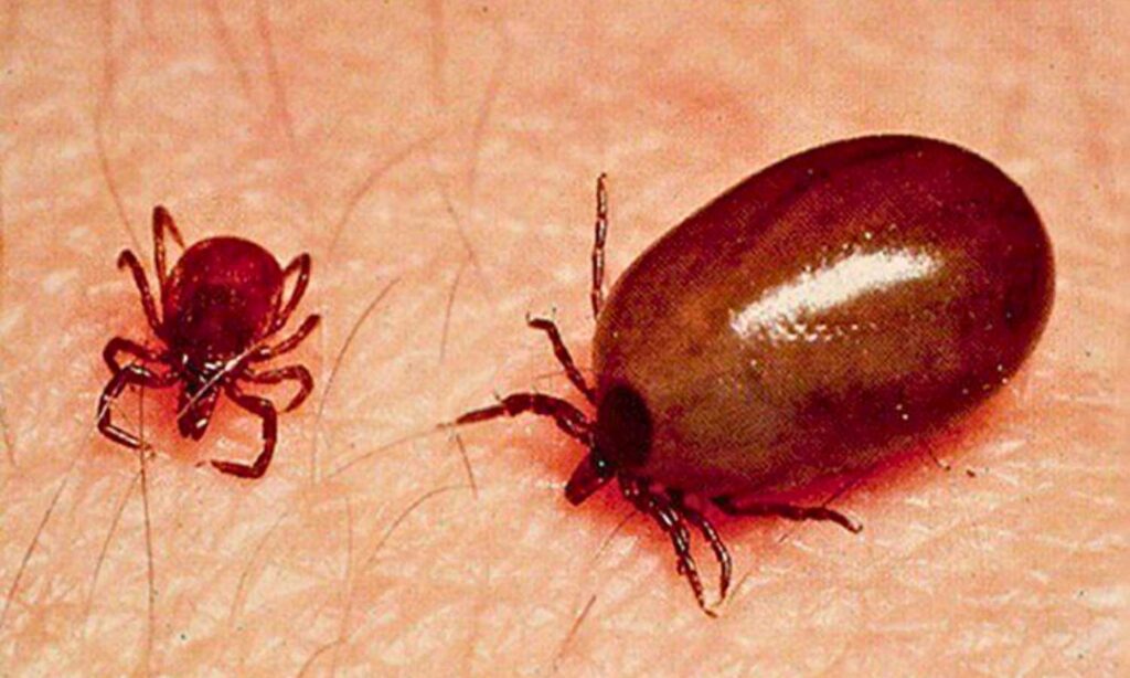 Scrub Typhus